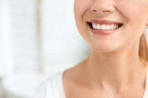 Veneers, The Alternative to Teeth Bleaching